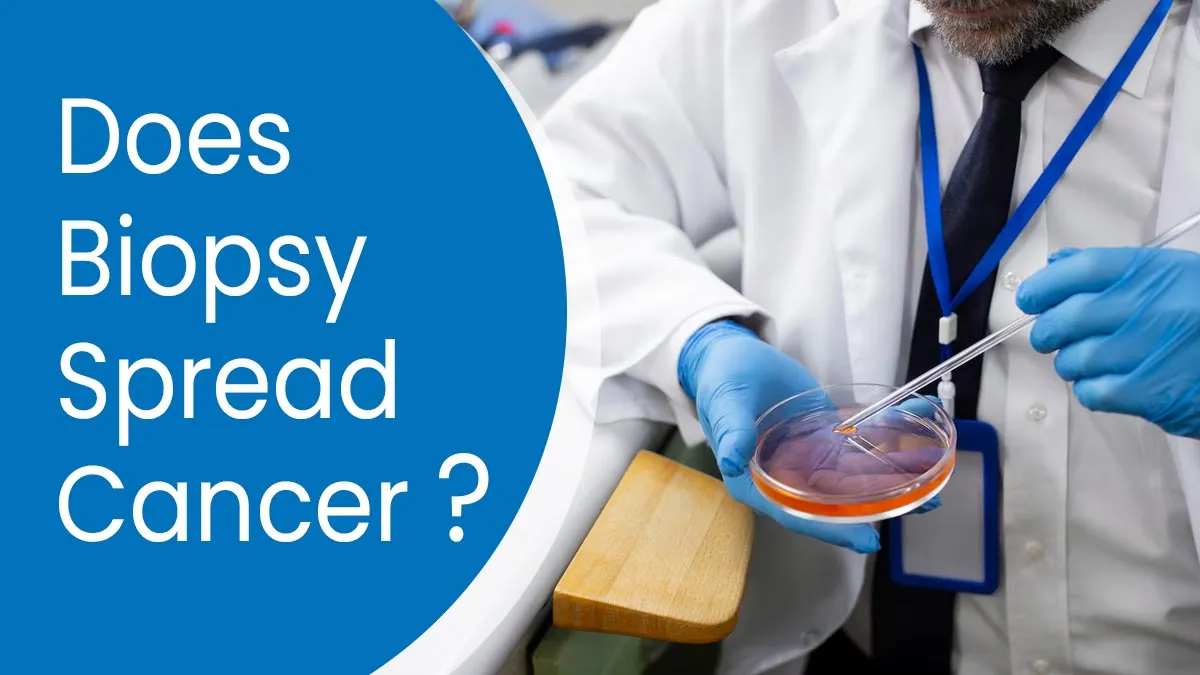 Do Biopsies Spread Cancer? Debunking Myths and Understanding the Facts