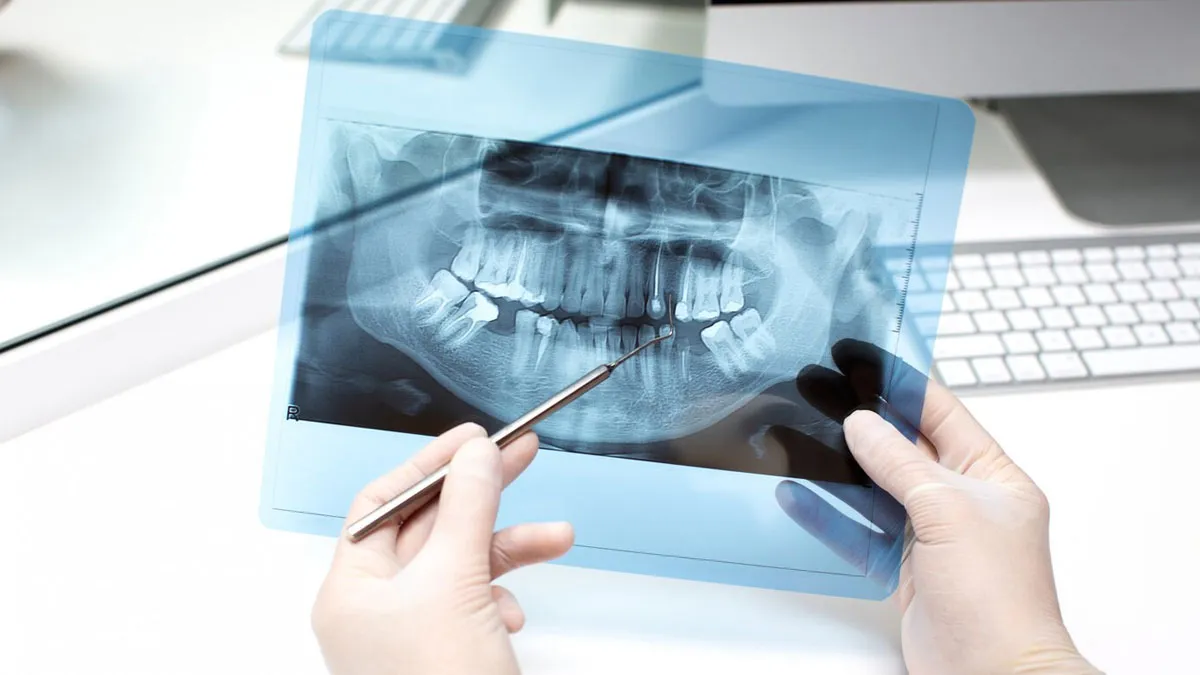 Dental X-Rays: Can They Increase Cancer Risk In Mouth?