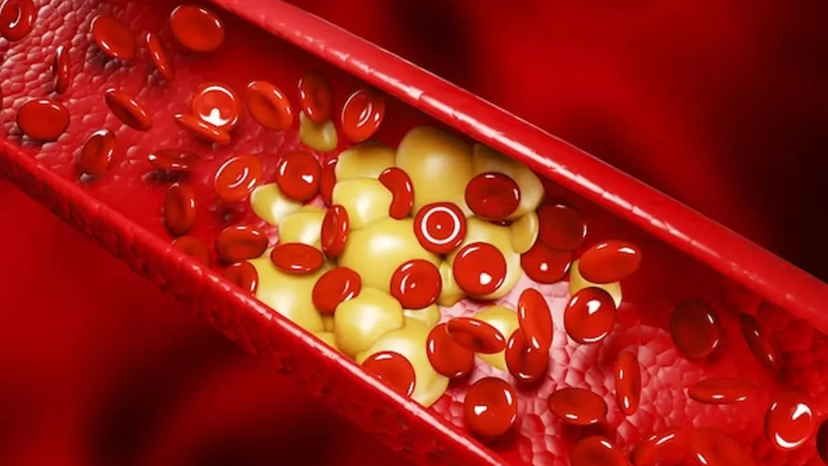 How Much Cholesterol Should You Have In A Day To Stay Healthy?