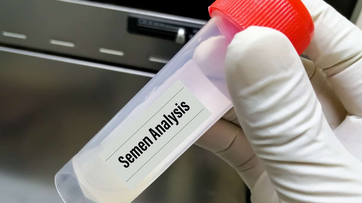 semen-analysis