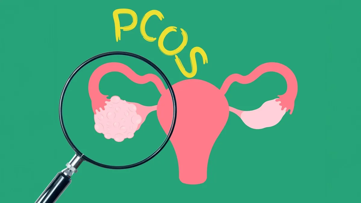 Managing PCOS: Why Dairy Can Be Problematic During PCOS And Alternatives To Try