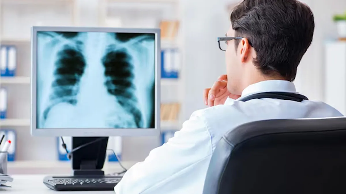How To Interpret Lung Nodules On A Chest X-Ray: Can They Be Cancerous?