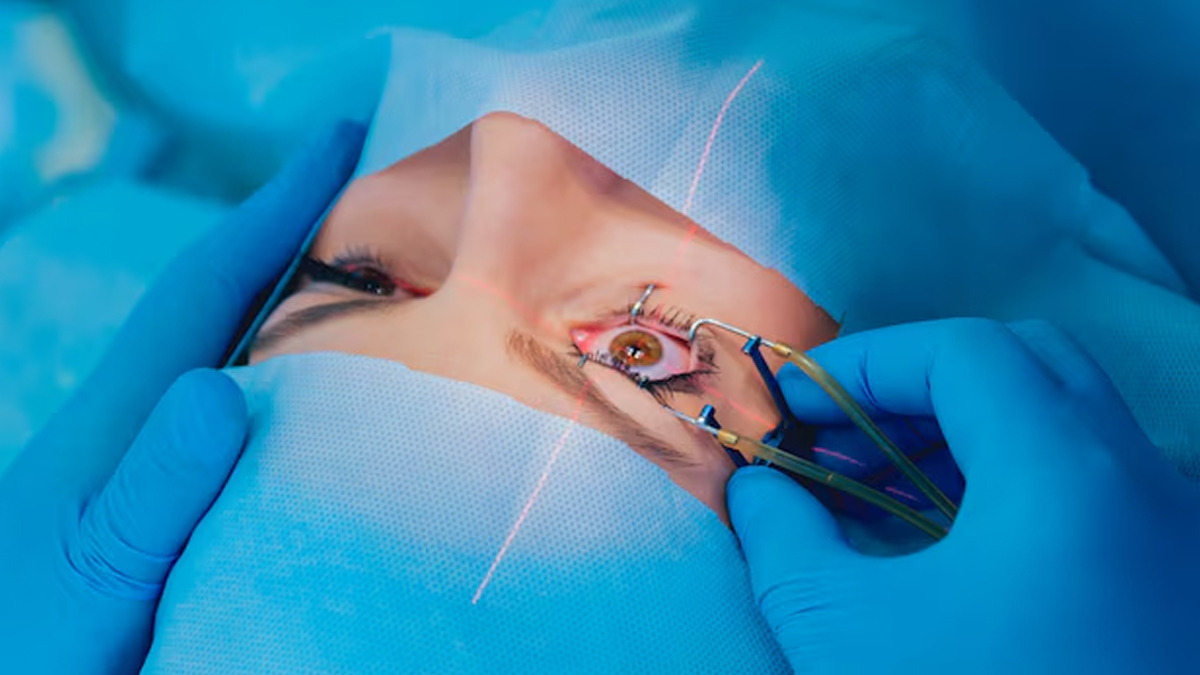 eye grafting 1 - 2025-04-02T114509.401