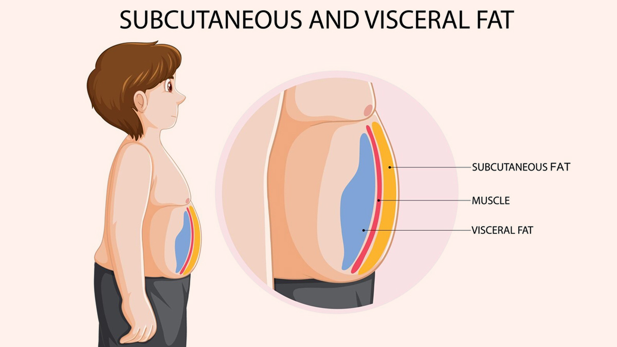 subcutaneous-vs-visceral-fat