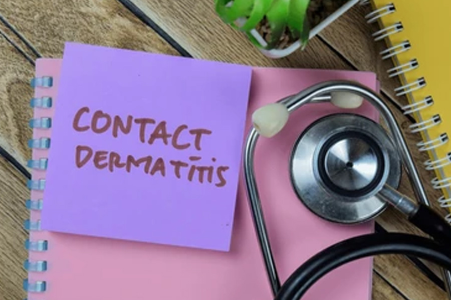 contact-dermatitis