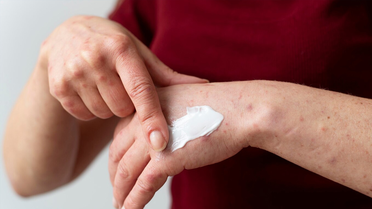 skin-allergy-treatment