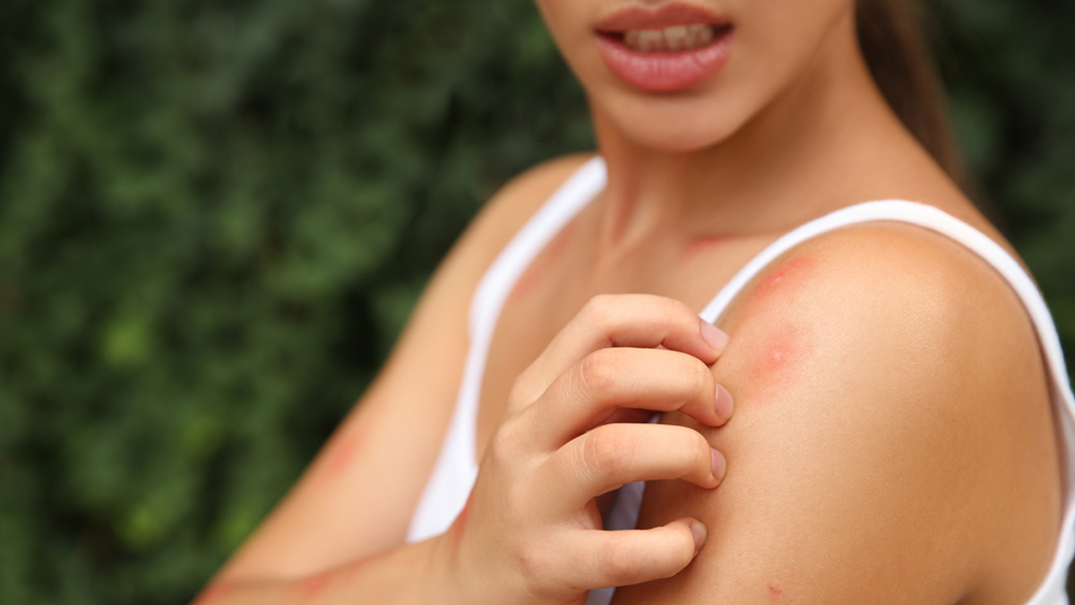 malaria