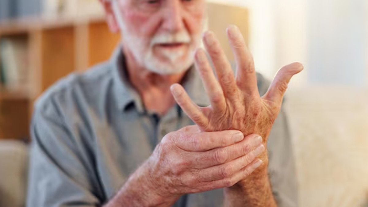 rheumatoid-arthritis