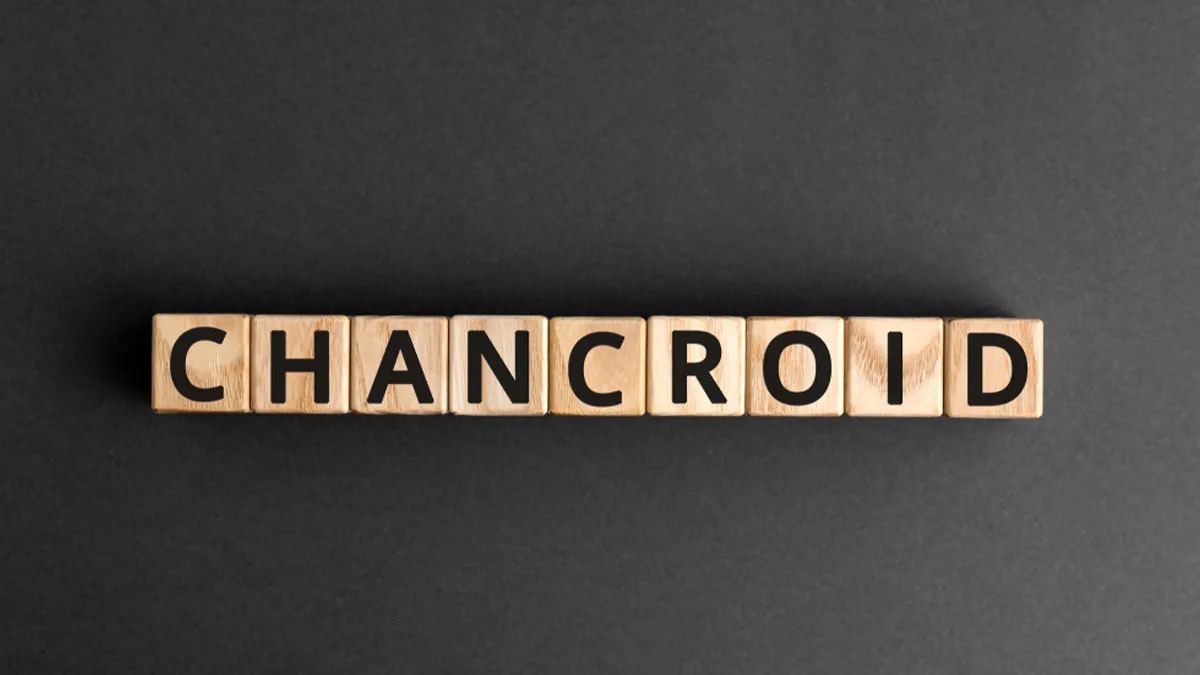 What Is Chancroid? A Sexually Transmitted Infection Characterised By Genital Ulcers