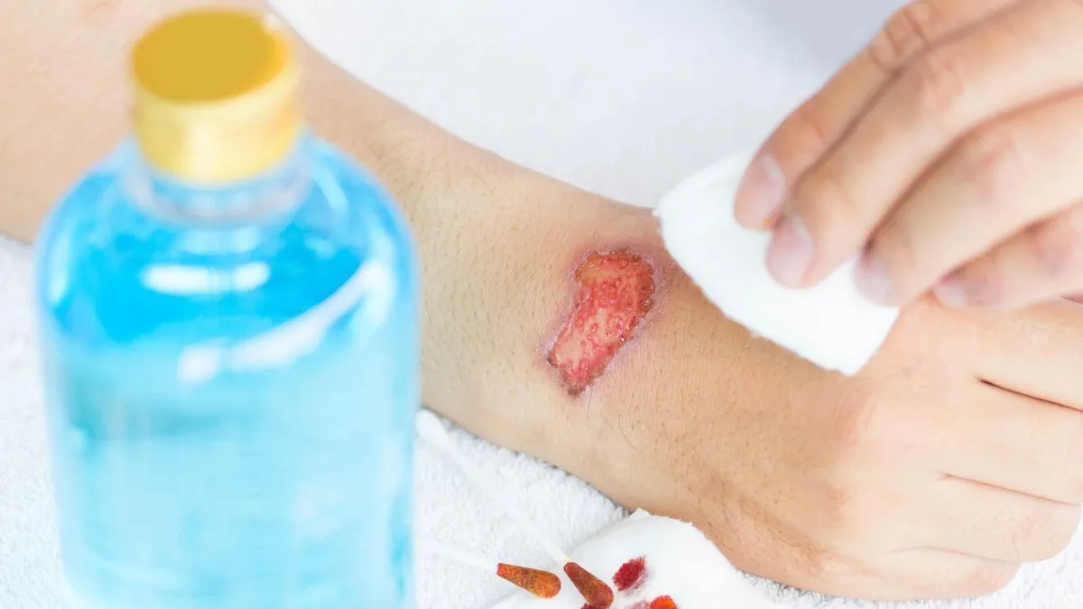 Is Dettol Safe or Harmful? Debunking Viral Video Claims By A Dermatologist