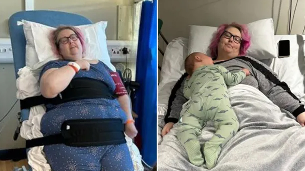 1-weight-loss-surgery