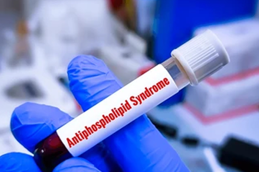 Antiphopholipid-Antibody-synrome