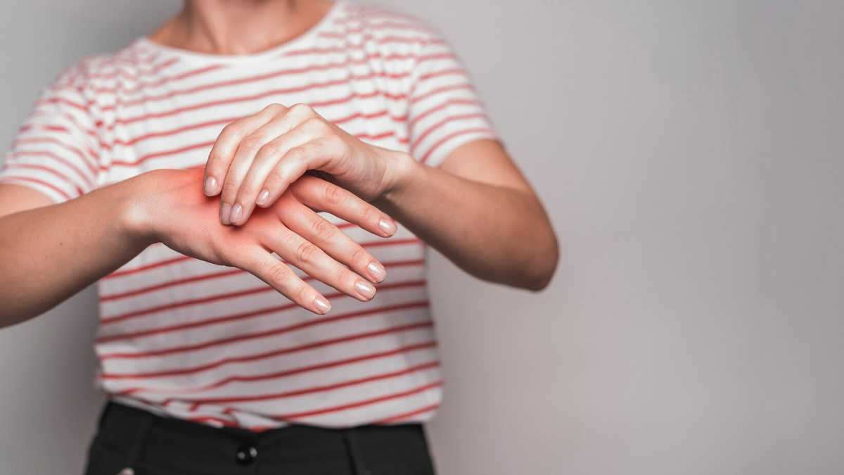 rheumatoid-arthritis