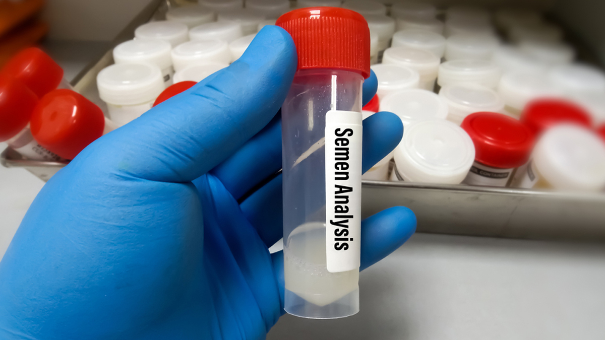 semen-analysis
