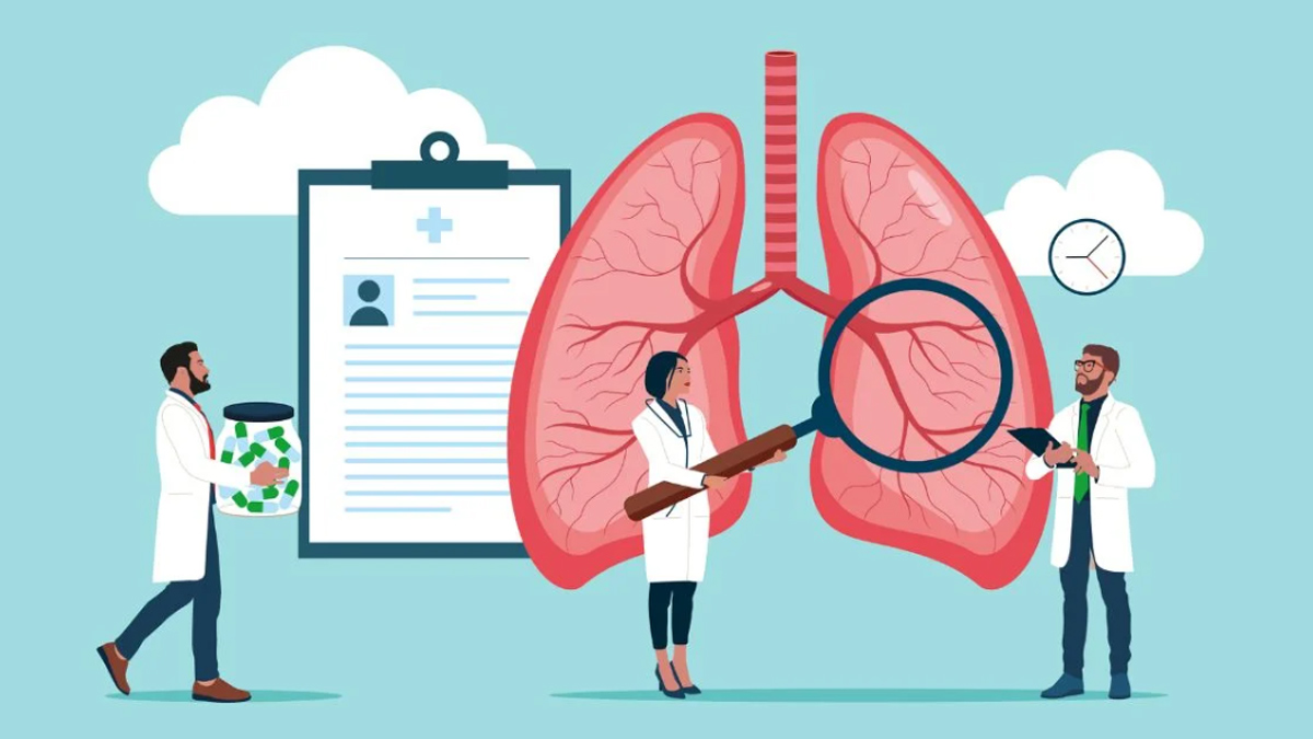 Chronic lymphocytic leukaemia (CLL) treatment 2 - 2025-04-11T141459.118