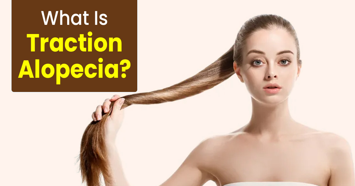 Can You Regrow Hair From Traction Alopecia? Here Is What An Expert Has To Say

