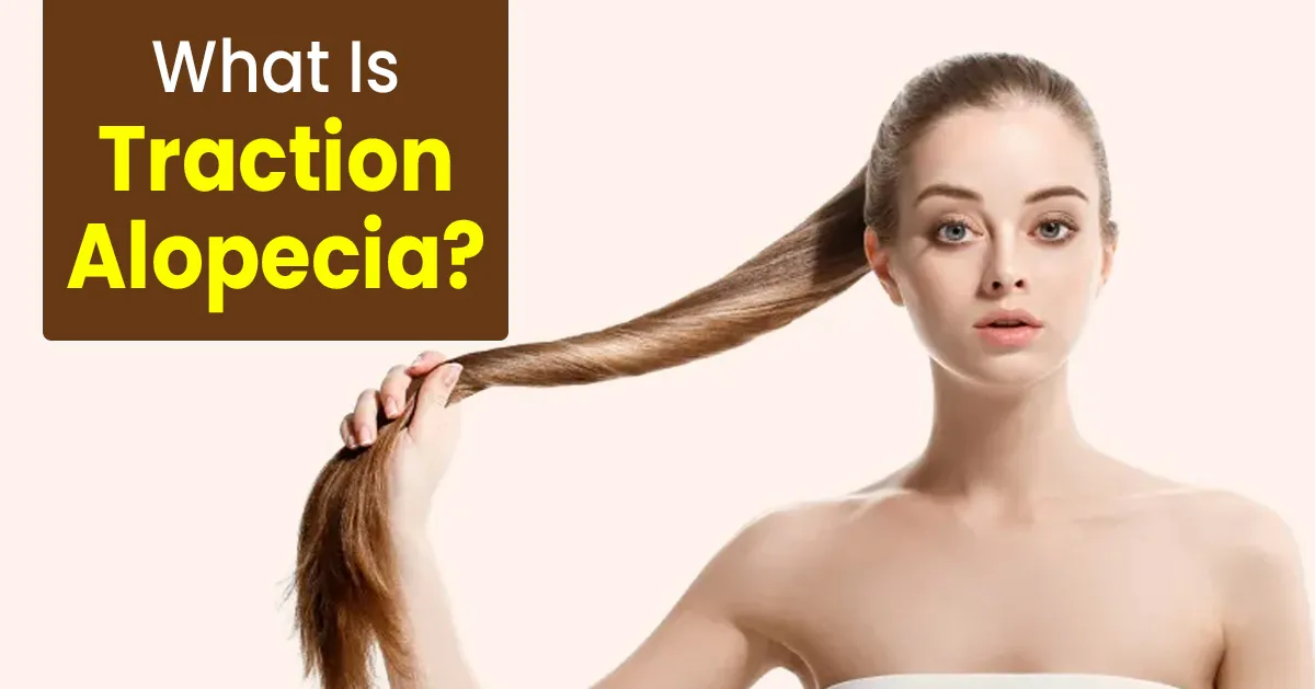Can You Regrow Hair From Traction Alopecia? Here Is What An Expert Has To Say
