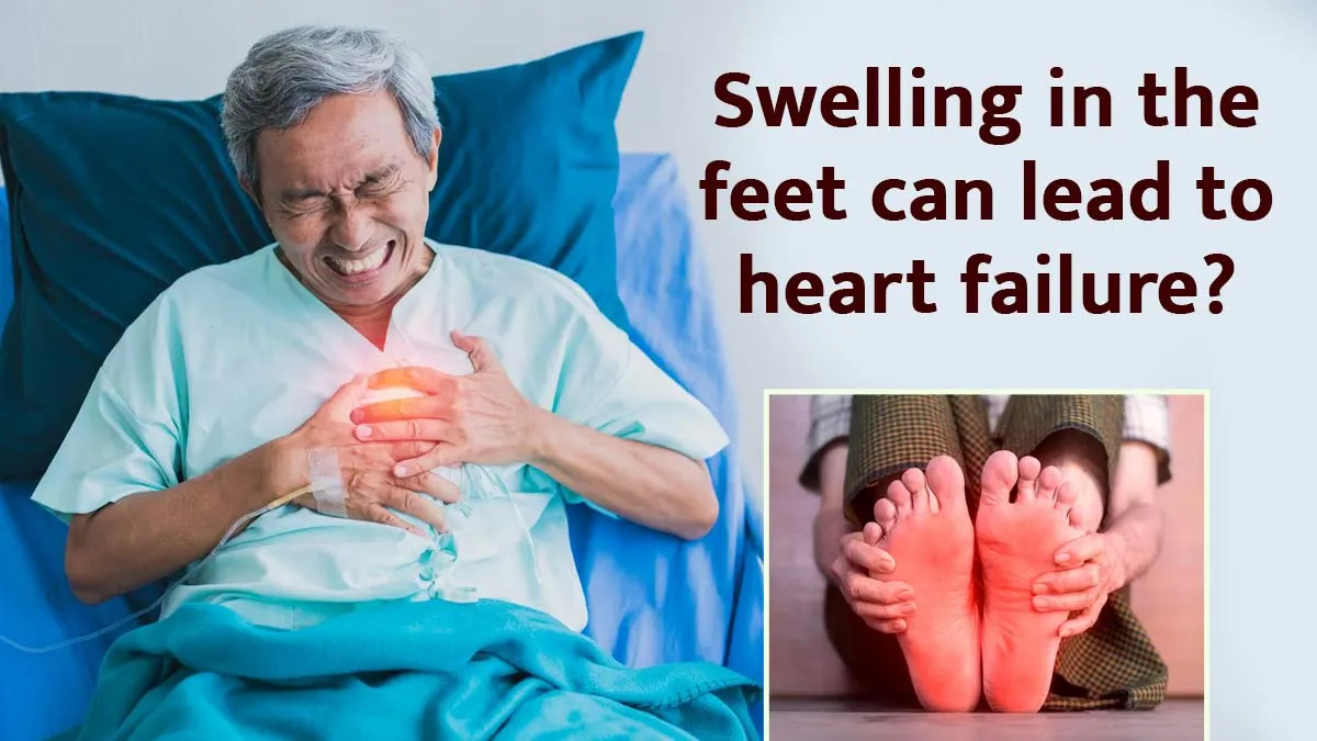 Is Swelling In The Feet A Sign Of Heart Failure? Here’s When To Be Concerned
