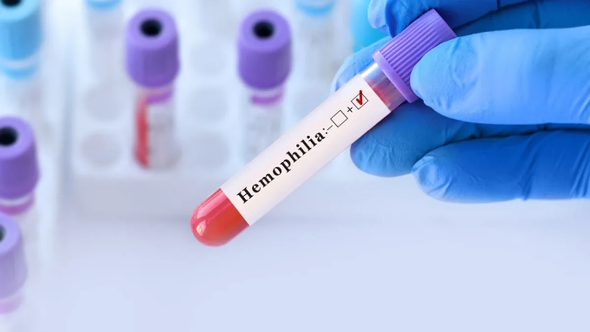 World Haemophilia Day 2025: Expert Explains How Early Diagnosis Improves Life Expectancy In People With Haemophilia