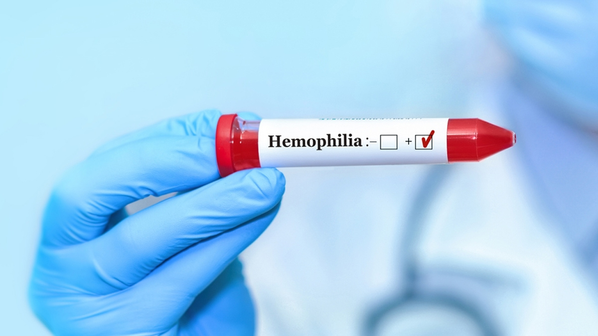 Haemophilia