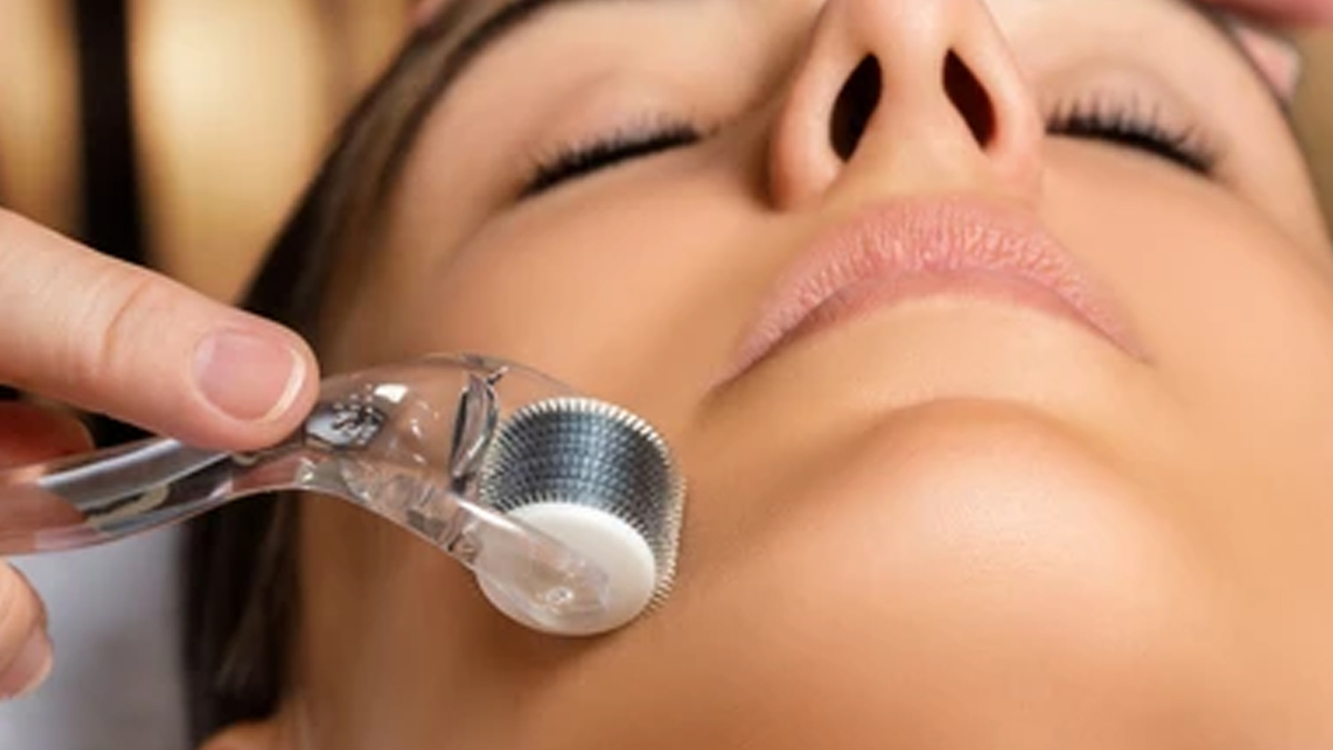 derma-roller-therapy