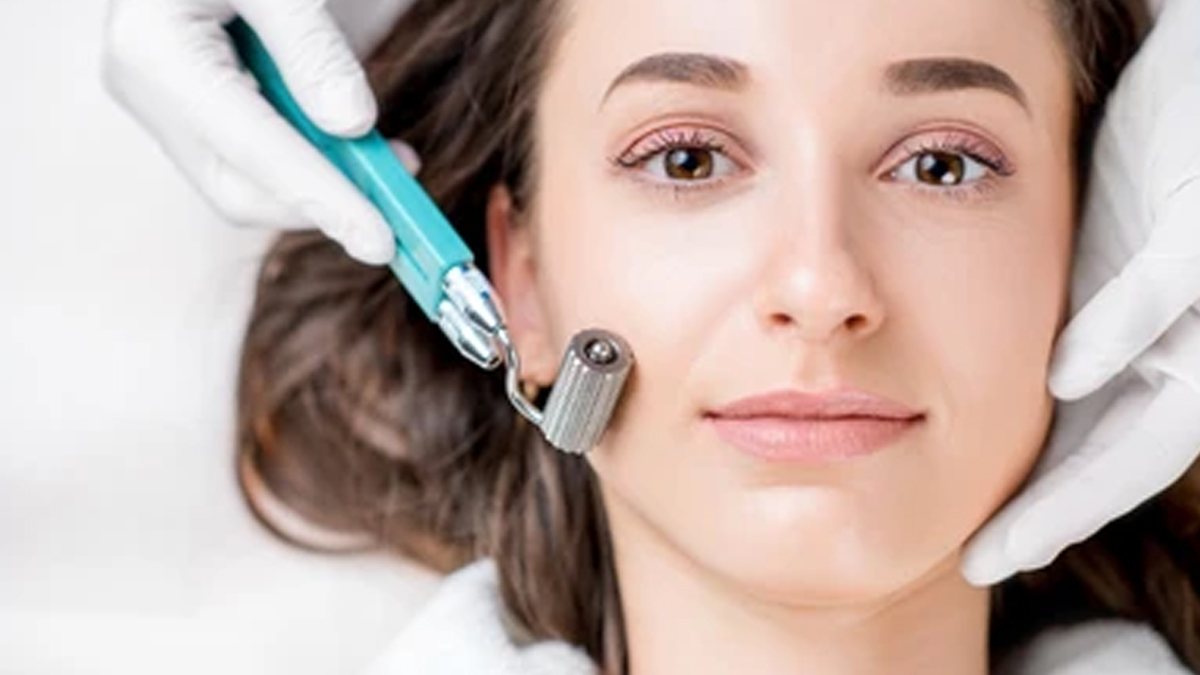 derma-roller-treatment
