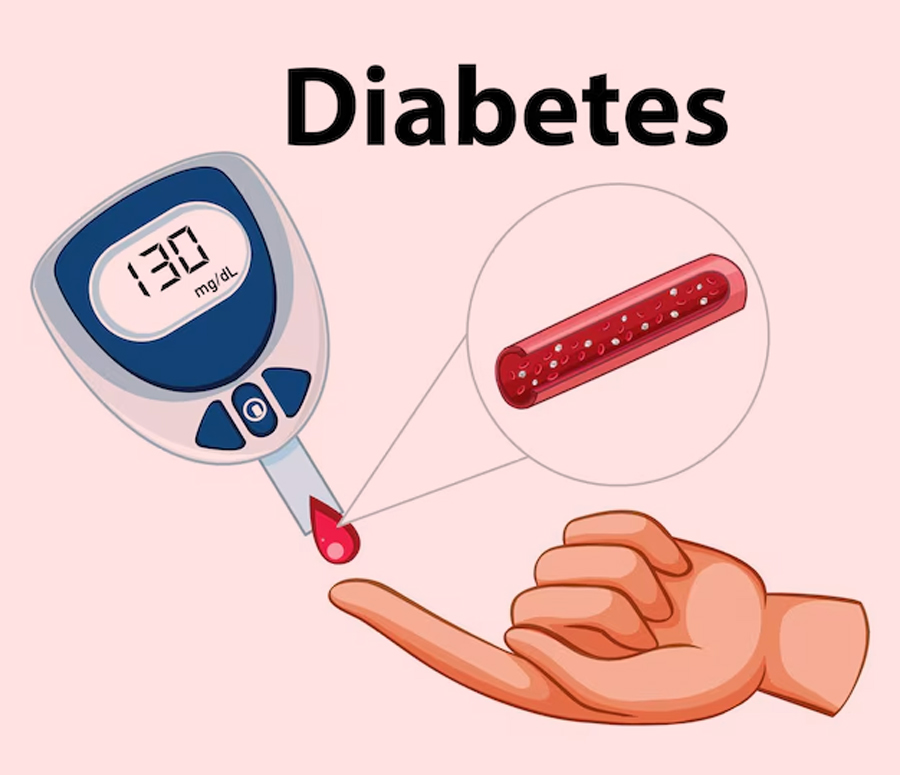 diabetes-diagnosis