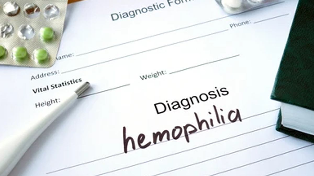 diagnosing-hemophilia