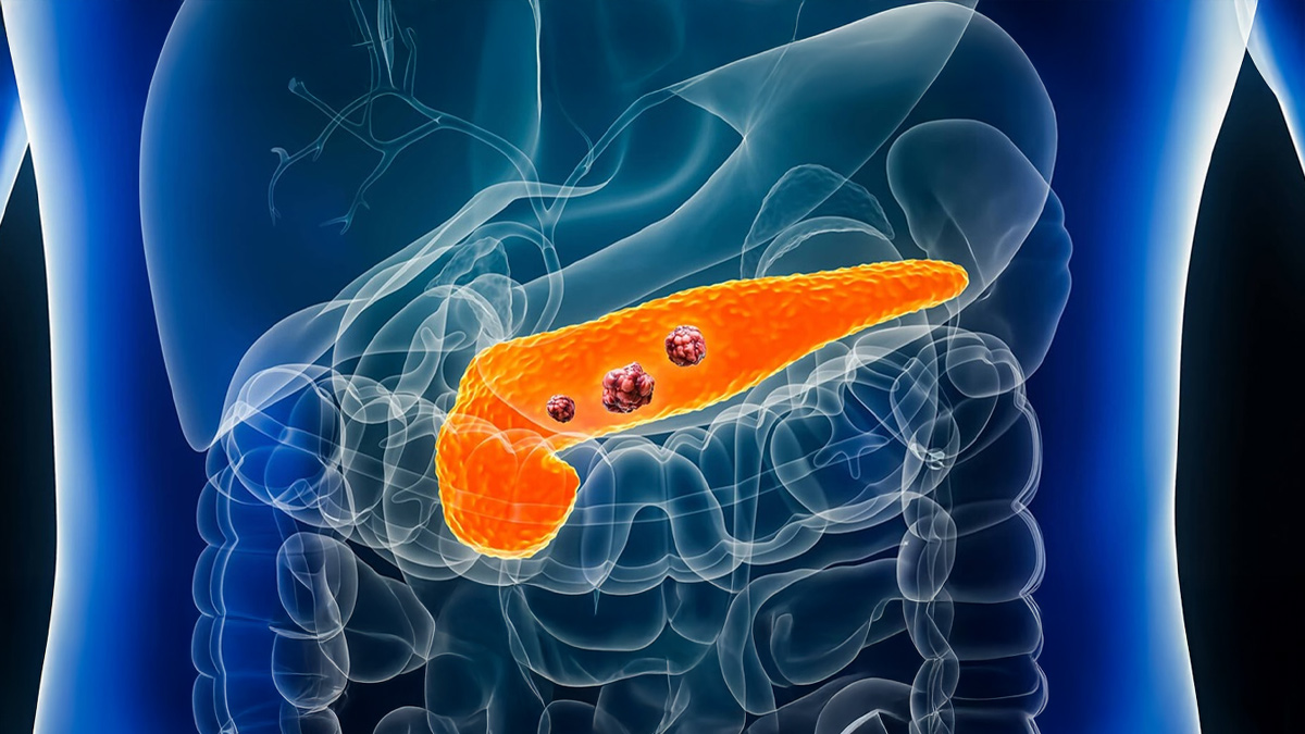 1 - 2025-04-21T111424.275