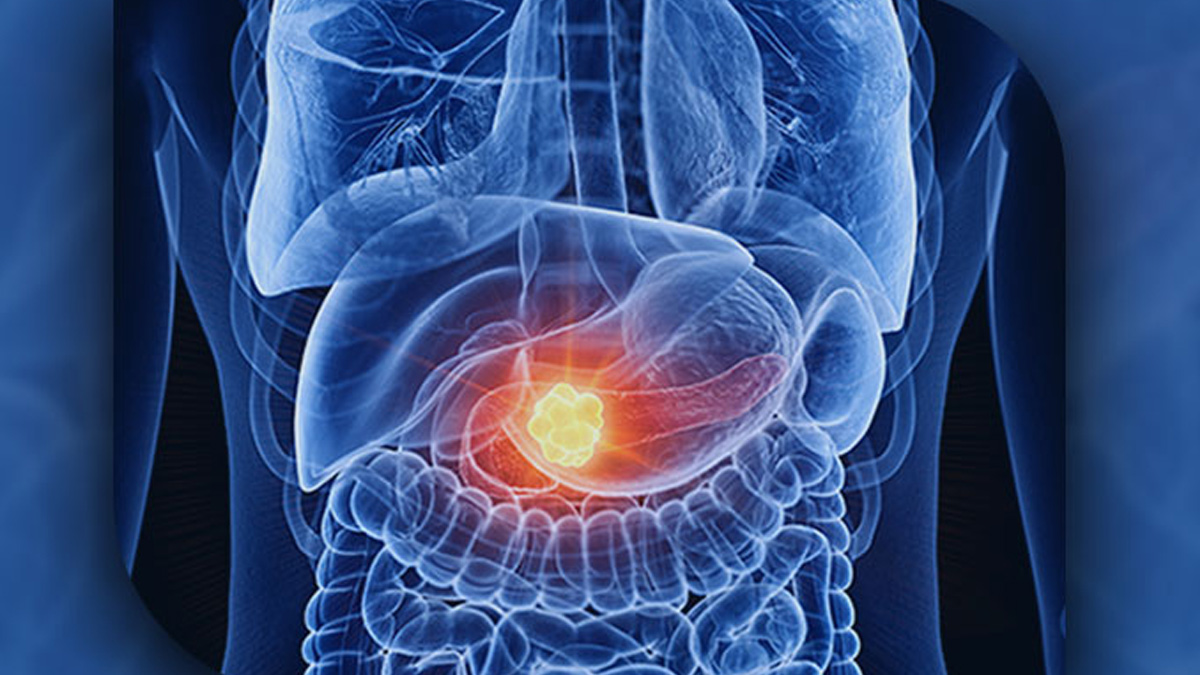 2 - 2025-04-21T111421.255