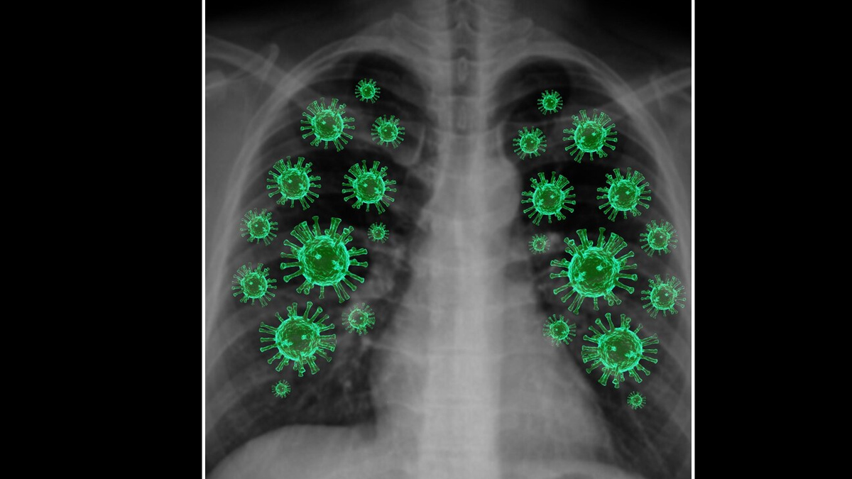 respiratory-infections