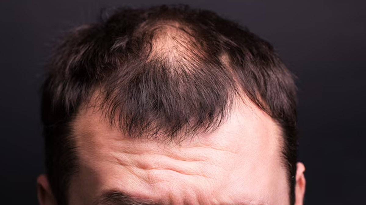 1 - 2025-04-23T162456.445