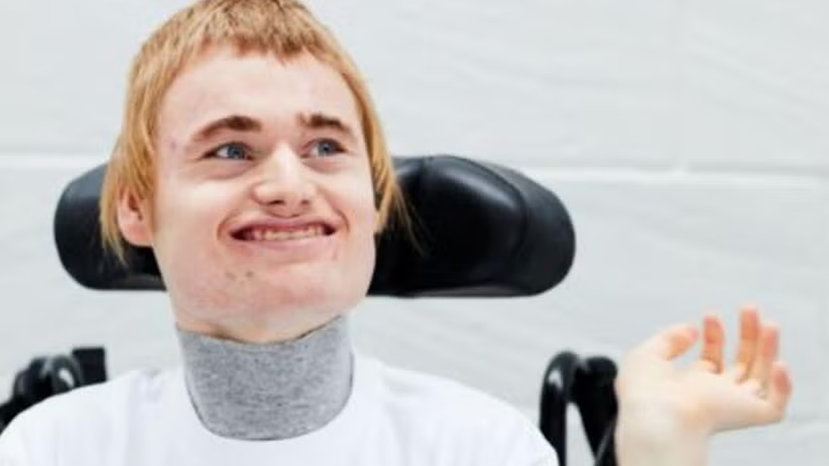 angelman syndrome 2 - 2025-04-23T103733.616