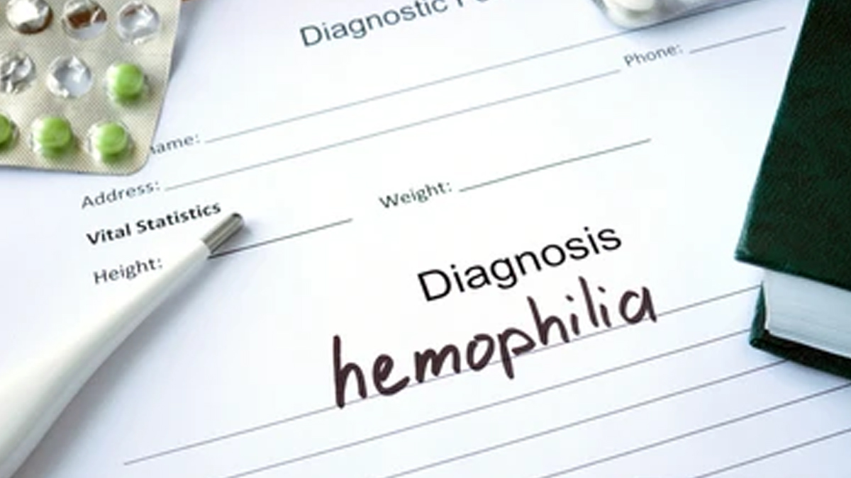 hemophilia-diagosis