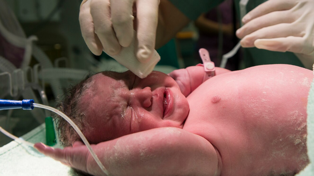 preterm-birth