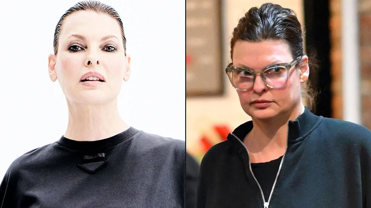 Linda Evangelista Still Avoids Mirrors 10 Years After CoolSculpting Trauma: How Paradoxical Adipose Hyperplasia Changed Her Life