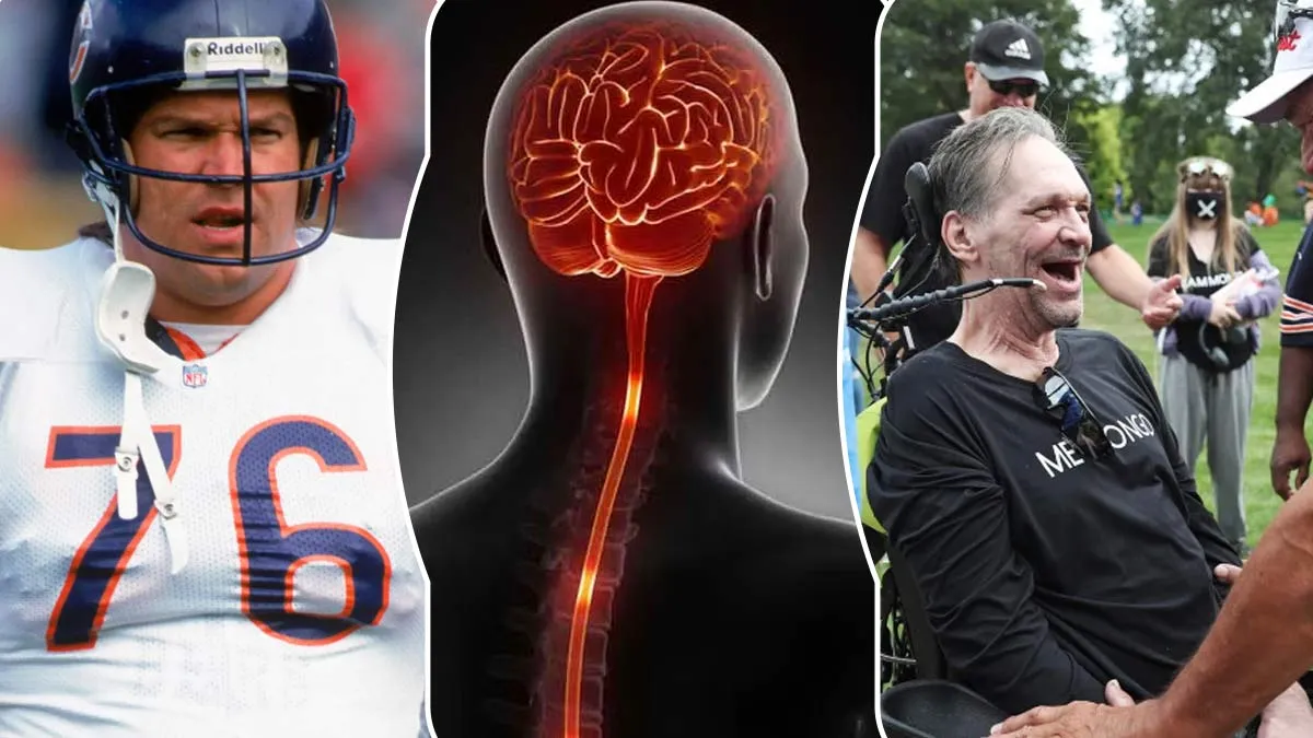What Is ALS? Exploring The Neurodegenerative Disease That Caused The Death of NFL Legend, Steve McMichael