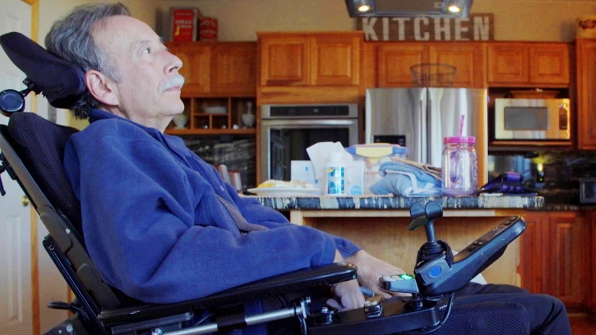 ALS Disease 2 - 2025-04-25T141417.302