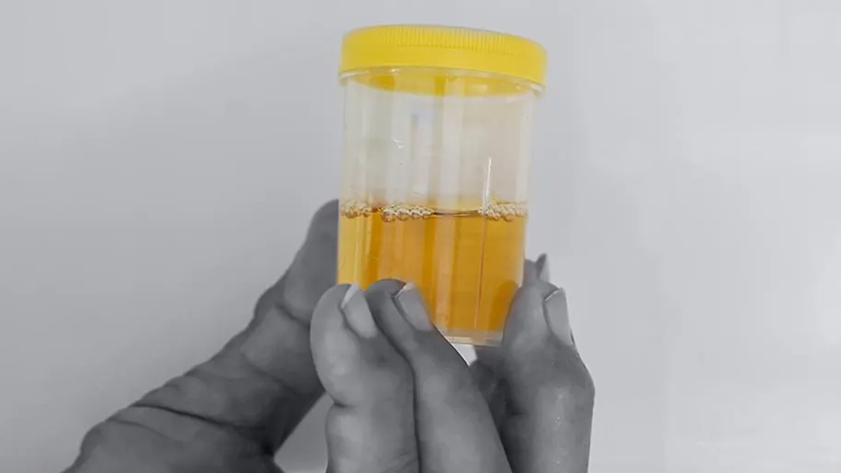 paresh rawal revealed urine helped in knee injury 1 - 2025-04-28T133418.907