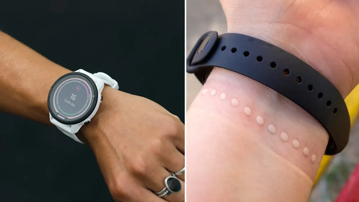 Are Tight Fitness Watches Giving You Accurate Results or Harming Your Nerves? Here’s What An Expert Says