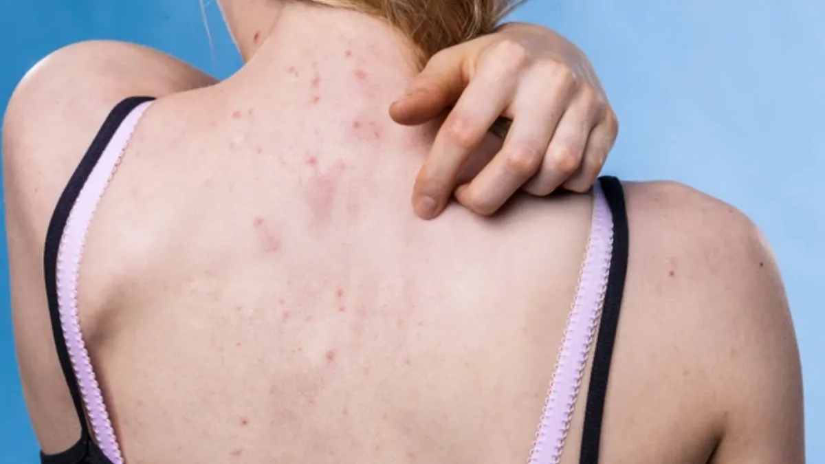 Let’s Talk About Bacne, Boob Sweat And Ingrowns: The Body Care Guide Nobody Gave You