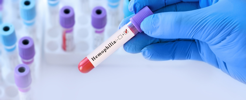 hemophilia