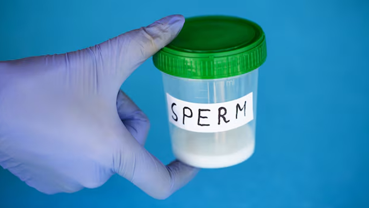 sperm