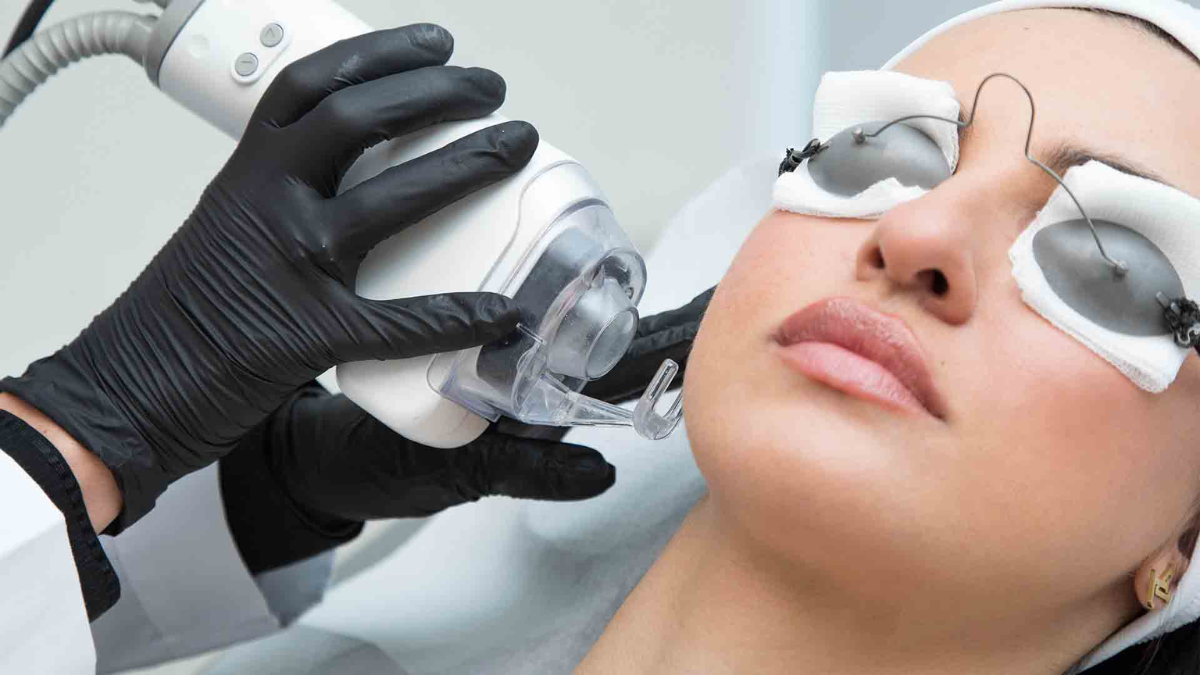 TikTok’s Latest Obsession: Is the Viral Fractional CO2 Laser Really Safe For Acne Scars?