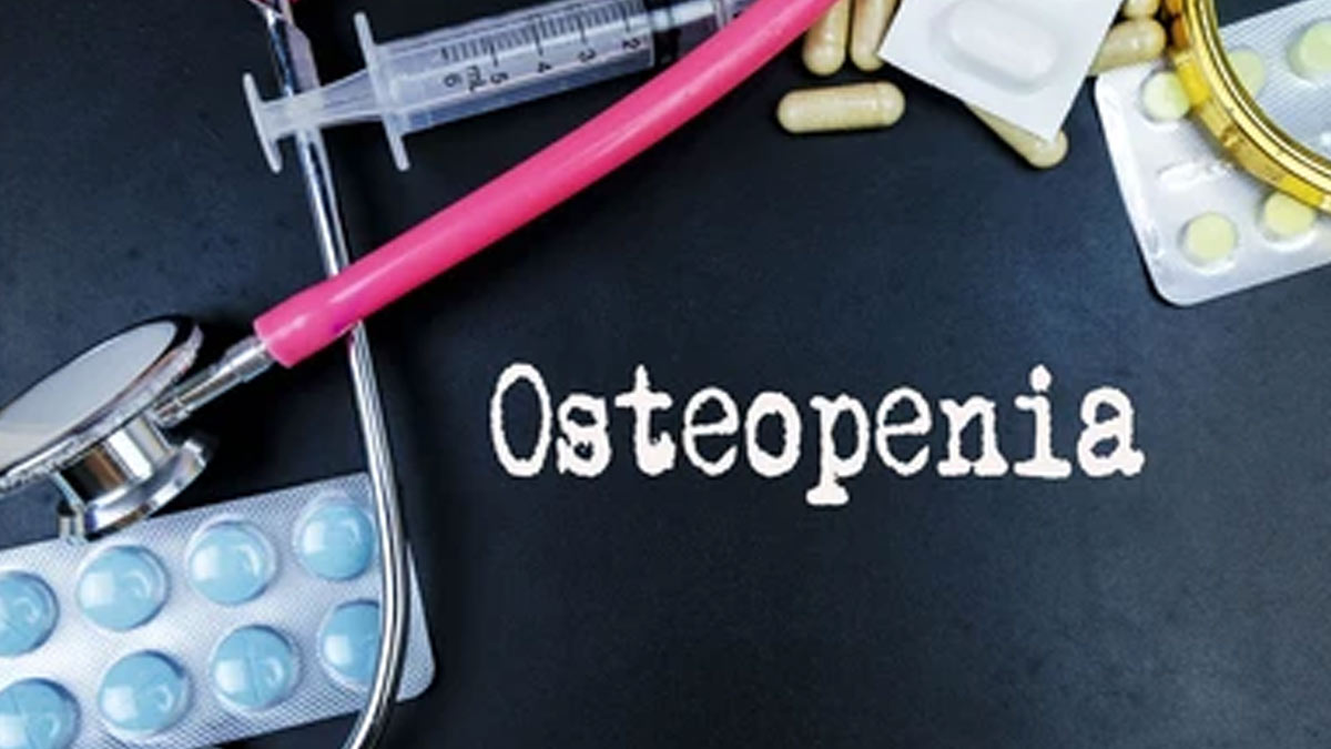 Joint Pain At 30? Expert Explains Why Osteopenia Isn’t Just An Old Age Problem Anymore
