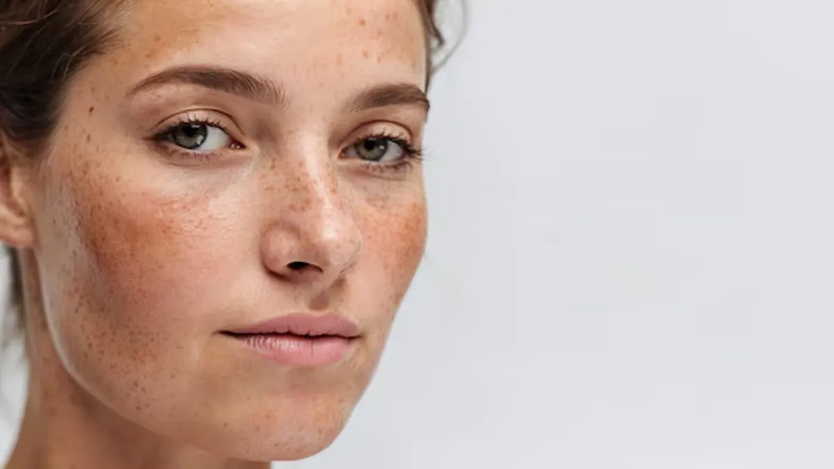 Are Freckles Just Beauty Marks Or Signs Of Deeper Skin Health Issues?