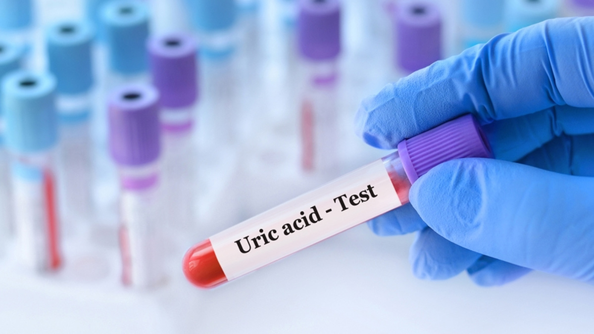 uric-acid