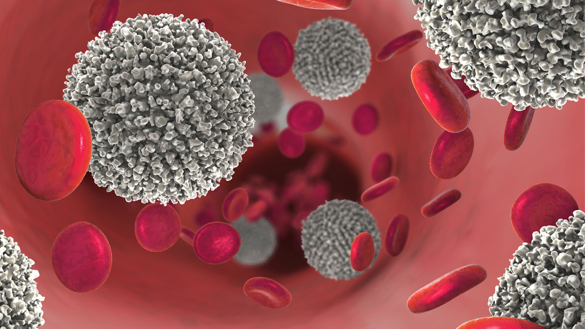 Leukaemia Breakthrough: New Test Spots Relapse Before Symptoms, Offering Life-Saving Head Start