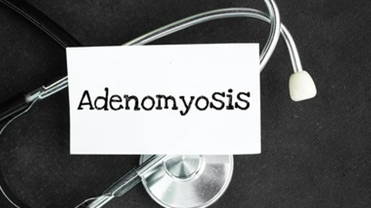 Adenomyosis