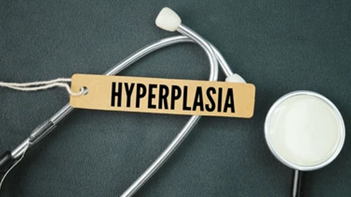 Hyperplasia
